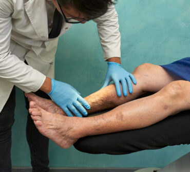Cropped photo of a male doctor examining a mature woman with varicose veins
