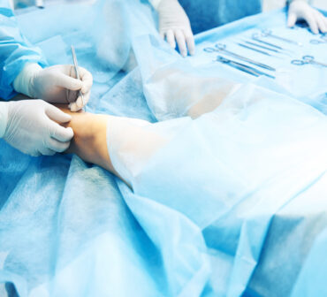 Close up of the patient in the operation theatre and a careful doctor touching his leg with a scalpel