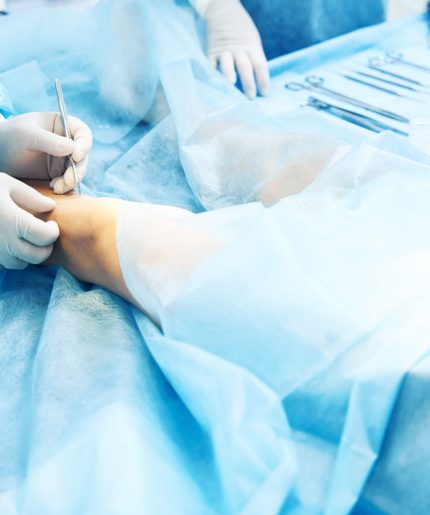 Close up of the patient in the operation theatre and a careful doctor touching his leg with a scalpel